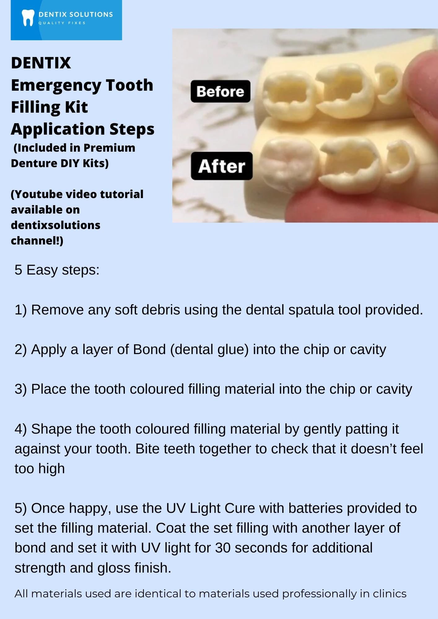 Chipped Tooth Filling Kit DIY Fix, Broken Teeth Emergency Repair Crafting Kit, Composite Filling (not a medical device)