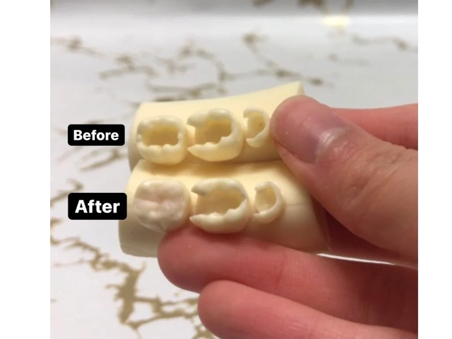 Chipped Tooth Filling Kit DIY Fix, Broken Teeth Emergency Repair Crafting Kit, Composite Filling (not a medical device)